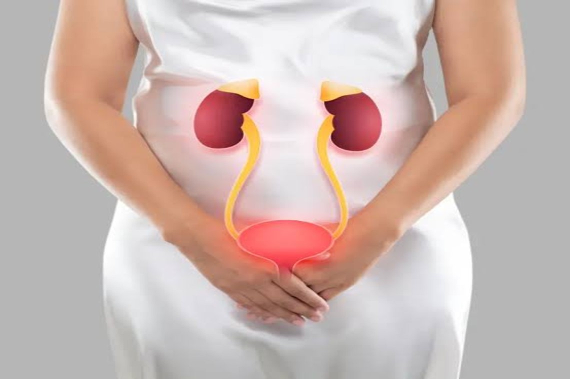 Urinary incontinence in women